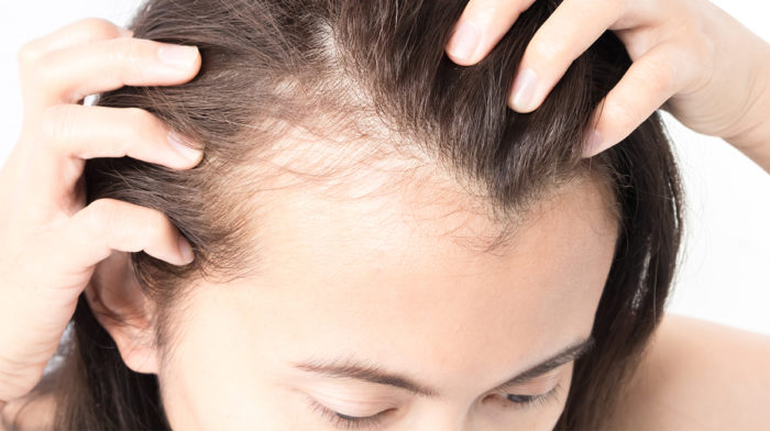 Ingredients to Strengthen Thinning Hair
