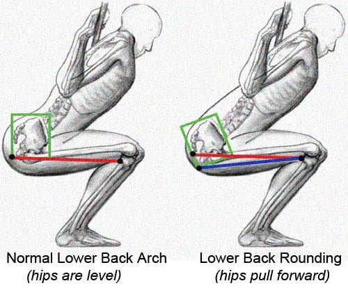 lower back rounding