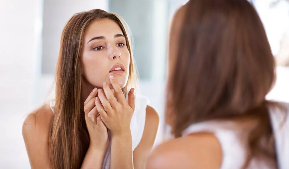 Skincare for Roaccutane Dos and Don'ts