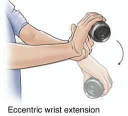 Eccentric Exercises For Golfers Elbow