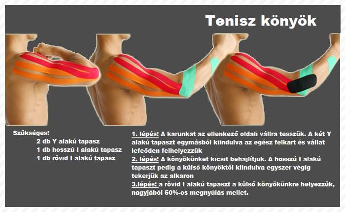 teraflex ízületi fájdalmak esetén hogyan lehet enyhíteni a fájó ízületeket rheumatoid arthritis