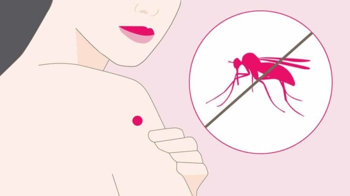 Mückenschutz: Das hilft wirklich gegen die kleinen Blutsauger