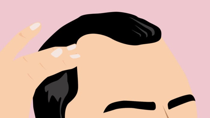 Diese Haarprobleme kennt MANN nur zu gut, aber was ist dagegen zu tun?
