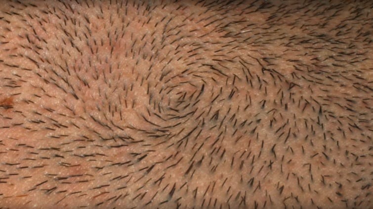 facial hair stubble